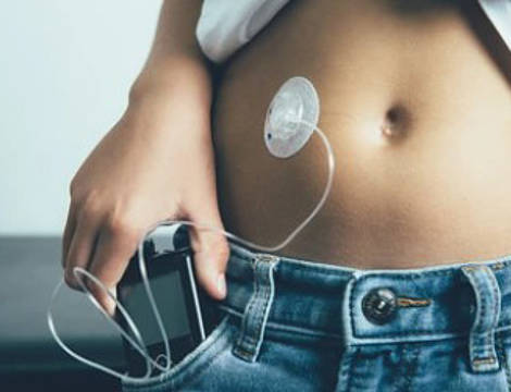 Wearable/drug delivery devices
