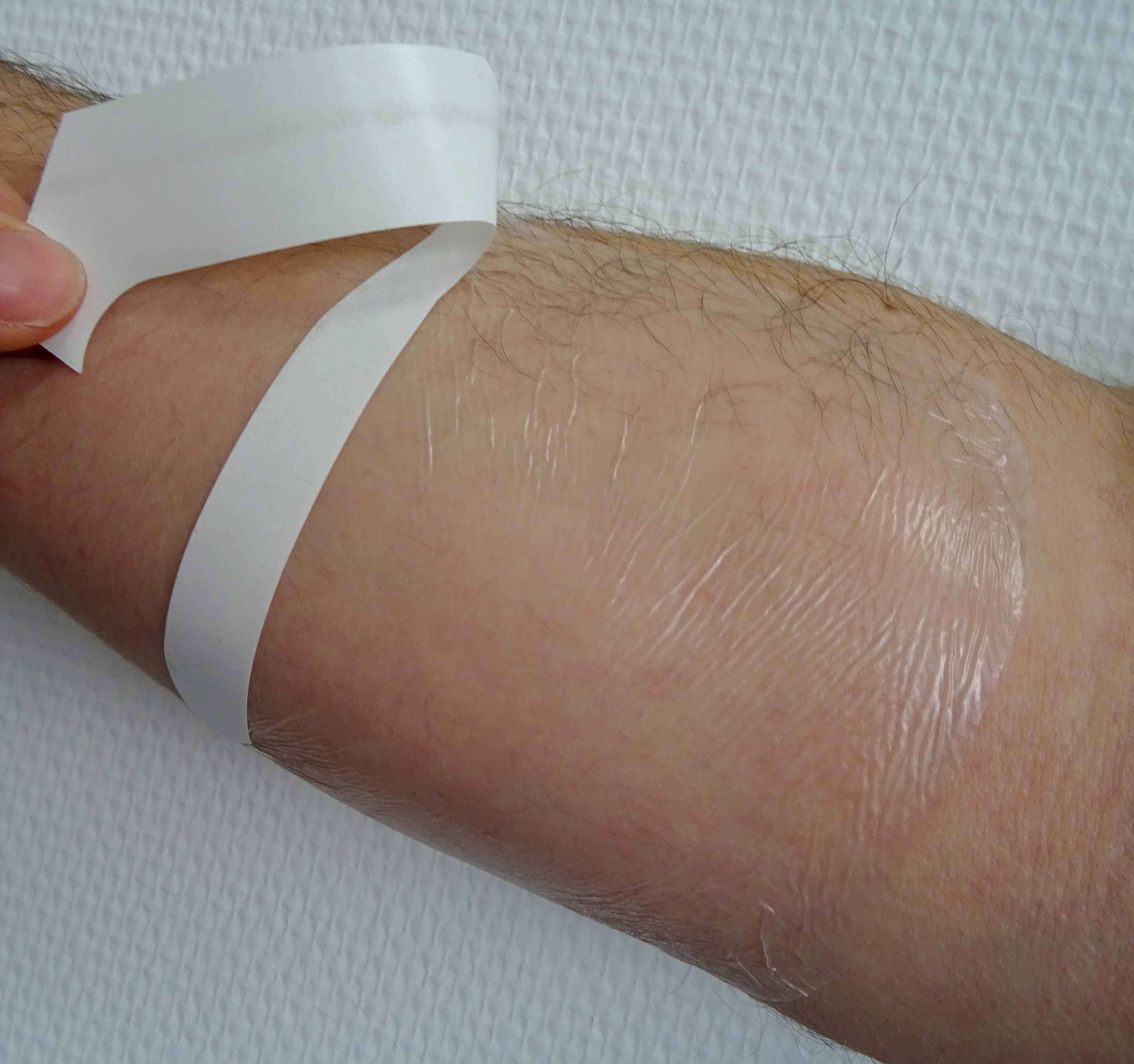 <ul><li>Single sided polyurethane film with silicone gel</li><li>Designed to protect insertion points as well as perilesional and sensitive skin</li><li>Can be removed without pain or trauma thanks to the silicone gel </li></ul>