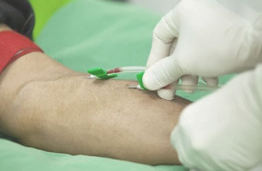 <ul><li>Einseitig klebender Verband aus weichem ungewebten Stoff und perforiertem PE</li><li>Verstärkt die Abdichtung um die Punktionsstelle bei der Dialyse</li></ul>