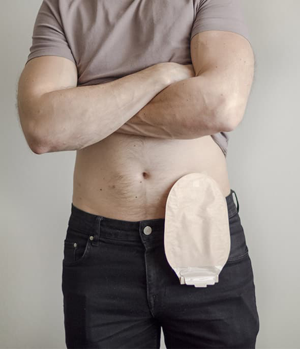 <ul><li>Película de poliuretano a una cara y gel de silicona para asegurar la bolsa de ostomía </li><li>Fijación invisible y extracción atraumática</li><li>Sistema de aplicación fácil de usar</li></ul>